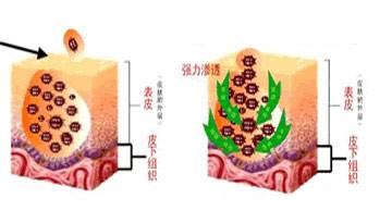 导致扁平疣产生的主要因素